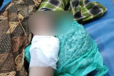 Tukang Busur Misterius Berulah, Samping Lutut IRT Tertancap Anak Panah - JPNN.com Sultra