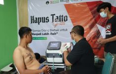 Bantu Kuatkan Hijrah Masyarakat, BMH Yogyakarta Gelar Layanan Hapus Tato - JPNN.com