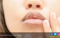 Cegah Bibir Kering Saat Puasa dengan 5 Cara Alami Ini - JPNN.com