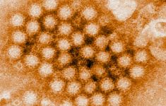 CDC: Kasus Norovirus di Amerika Serikat Terus Meningkat Tajam - JPNN.com