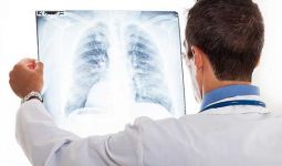 Ini 7 Cara Membersihkan Paru-paru Perokok - JPNN.com