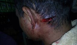 Bripka Awaludin Ditembak Dua Kali di Kepala, Lihat Nih Fotonya... - JPNN.com