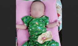 Tolong! Bayi Muhamad Arpan Butuh Bantuan, Lahir Tanpa Anus - JPNN.com