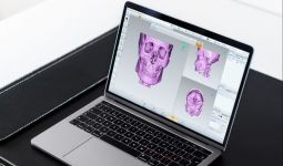 RS Mandaya Terapkan Teknologi 3D dalam Proses Medis - JPNN.com