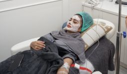 Biaya Lanjutan Mochi Level Up Treatment Bikin Melongo, Sebegini Harganya - JPNN.com