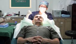 Shandy Sjariff Makin Percaya Diri setelah Transplantasi Rambut - JPNN.com