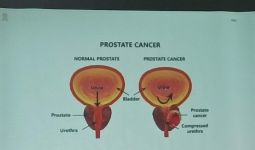 Cek Fakta: Apakah Benar Masturbasi Bisa Kurangi Risiko Kanker Prostat? - JPNN.com