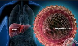 IDI Woha Bagikan Informasi Pengobatan Mengenai Penyakit Hepatitis - JPNN.com