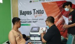 Bantu Kuatkan Hijrah Masyarakat, BMH Yogyakarta Gelar Layanan Hapus Tato - JPNN.com