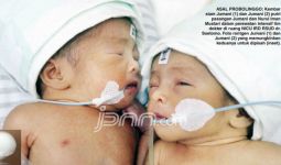 Suara Rengekan Bayi Kembar Siam Bikin Hati Miris - JPNN.com