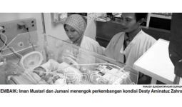 Usai Dioperasi, Kondisi Bayi Kembar Siam Membaik - JPNN.com