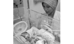 Innalillahi, Bayi Kembar Siam Itu Pergi - JPNN.com