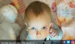Bayi Cantik Ini Mirip Putri Tidur, Bisa Terlelap Seminggu - JPNN.com