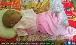 Dua Bayi di Kota Batam Ini Alami Gizi Buruk, Memprihatinkan Sekali... - JPNN.com