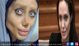 Nasib, Pengin Seperti Angelina Jolie, Jadinya Mirip Zombi - JPNN.com