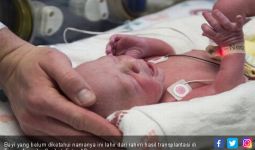 Luar Biasa, Bayi Lucu Ini Lahir dari Rahim Transplantasi - JPNN.com
