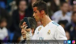 Real Madrid Pesta Gol, Cristiano Ronaldo Berdarah - JPNN.com