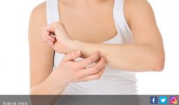 4 Alasan Alergi Semakin Buruk di Malam Hari - JPNN.com