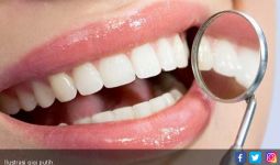7 Tips Jitu Hilangkan Karang Gigi Secara Alami - JPNN.com
