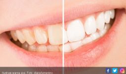 3 Cara Mudah Putihkan Gigi yang Menguning - JPNN.com