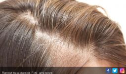 Rambut Menipis, Kenali 5 Kesalahan dalam Merawatnya - JPNN.com