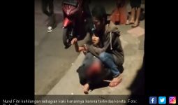 Kaki Kanan Wanita Ini Putus Usai Terlindas Kereta Jurusan Sukabumi–Bogor - JPNN.com