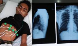 Dor, Mahasiswa NTT di Tangsel jadi Korban Penembakan, Peluru Pecah di Paru-paru - JPNN.com
