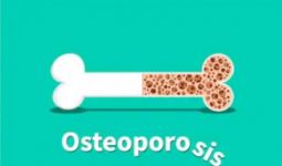 6 Cara Terbaik Menghindari Tulang Keropos Akibat Osteoporosis - JPNN.com