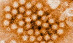 5 Fakta tentang Norovirus, Virus Lama yang Muncul Kembali - JPNN.com