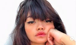 Dylan Sada, Model Cantik Asal Indonesia Meninggal Dunia - JPNN.com