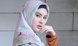 Dituduh Kena Azab, Kartika Putri Ungkap Kondisi Wajahnya - JPNN.com