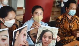 Jadi Korban KDRT, Nindy Ayunda Tunjukkan Foto Lebam di Wajah Hingga Rambut Rontok - JPNN.com