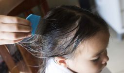 5 Cara Mengatasi Kutu Rambut pada Anak - JPNN.com