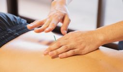 Benarkah Pengobatan Akupunktur Bisa Mengatasi Insomnia? - JPNN.com