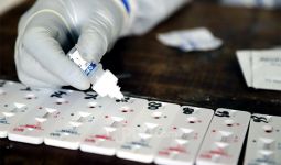 Buntut Alat Rapid Test Antigen Bekas, Dirut Kimia Farma Diagnostik Ikut Diperiksa Polisi - JPNN.com