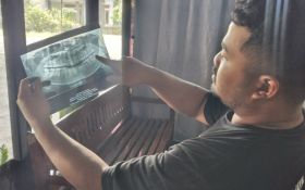 Kisah Pilu Wanita di Ngawi Cabut Gigi Bungsu Berujung Maut, Begini Kronologinya - JPNN.com Jatim