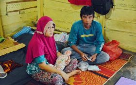 Bayi Mungil Penderita Omfalokel di Padangsidimpuan Butuh Bantuan Dermawan - JPNN.com Sumut