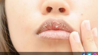 Cegah Bibir Kering Saat Puasa dengan 5 Cara Alami Ini - JPNN.com