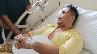 Jadi Korban Pengeroyokan, Perwira Polri Harus Operasi Hidung yang Patah - JPNN.com Banten