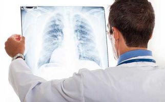 Ini 7 Cara Membersihkan Paru-paru Perokok - JPNN.com