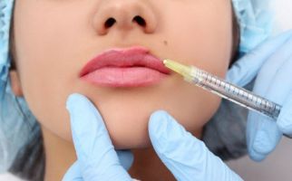 Alternatif Operasi Plastik, Apa Saja Keunggulan dan Risiko Filler? - JPNN.com