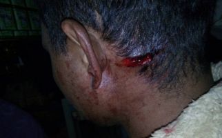 Bripka Awaludin Ditembak Dua Kali di Kepala, Lihat Nih Fotonya... - JPNN.com