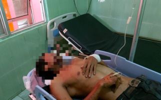 Cemburu, Istri Muda Nekat Tusuk Suami, Pisau Tertancap di Wajah Selama 8 Jam - JPNN.com