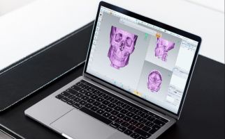 RS Mandaya Terapkan Teknologi 3D dalam Proses Medis - JPNN.com