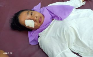 Nanang Siram Istri dan Anak dengan Air Keras, Kondisi Keduanya Mengenaskan - JPNN.com
