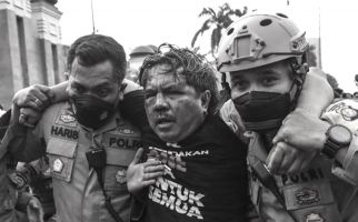 Ade Armando Sempat Muntah Darah Seusai Dikeroyok saat Demo 11 April - JPNN.com