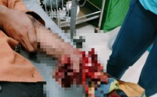 Detik-detik Tangan Mirda Hancur Terkena Ledakan Petasan, Bikin Merinding - JPNN.com