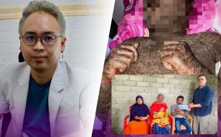 Penjelasan Dokter Soal Pria yang Kulitnya Bersisik Setelah Minum Kolagen, Ternyata Ini Sebabnya - JPNN.com