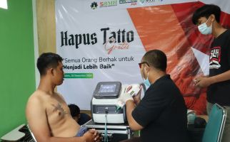 Bantu Kuatkan Hijrah Masyarakat, BMH Yogyakarta Gelar Layanan Hapus Tato - JPNN.com