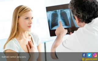 Kanker Paru Bukan hanya Karena Rokok, Simak Penjelasan Dokter Spesialis - JPNN.com